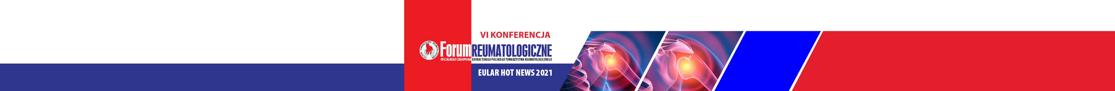 Virtual Meeting czasopisma Forum Reumatologiczne - EULAR 2021 HOT NEWS